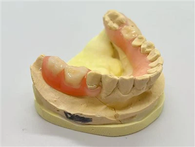Flexible Base Denture